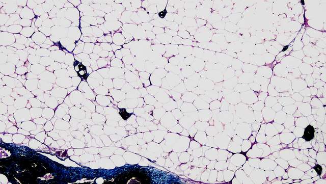Fat tissue under a microscope: many large, empty-looking round cells with thin purple walls.