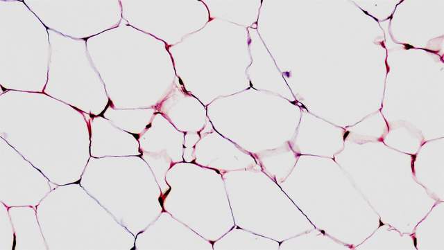 Fat tissue under a microscope: large, pale, many-sided fat cells with thin pink walls, packed tightly together.