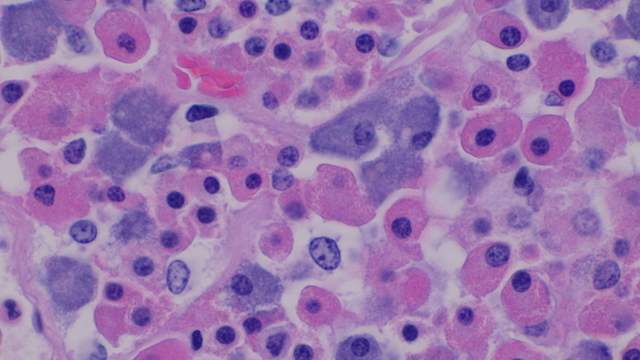A thin slice of gland tissue under a microscope. Round cells stained pink, purple or pale blue lie close together, each with a dark centre.