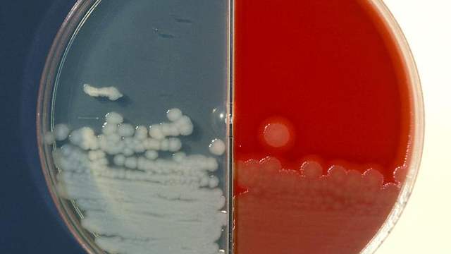 A round lab dish split into a clear half and a red half, with creamy white bacterial colonies growing across both.