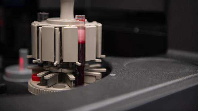 A small tube of blood stands in a round holder inside a grey laboratory machine.