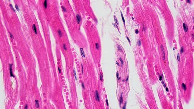 Heart muscle under a microscope: long pink fibres with dark purple cell nuclei.