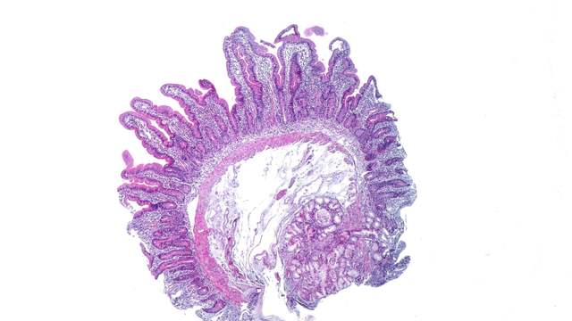 A thin slice of gut wall under a microscope, stained purple and pink. Many finger-like folds point outwards from a curved base.