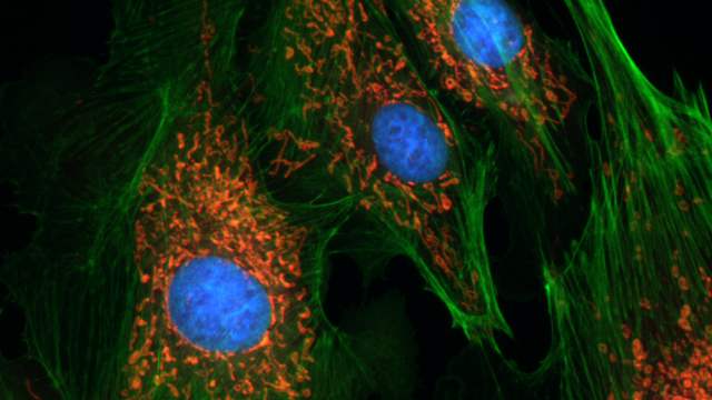Cells under a microscope on a black background, with blue round centres, green threads and small orange specks.