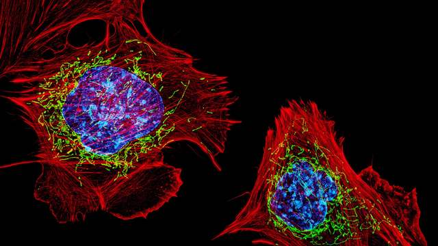 Three cells on a black background under a microscope. Fine red threads fill each cell, with a blue centre and small green worm-like shapes.