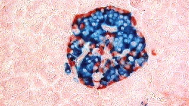 A thin slice of pancreas under a microscope. A round cluster of cells stained dark blue, edged with red cells, sits in pale pink tissue.