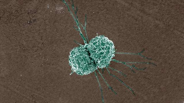 Colourised electron microscope image of a round, bumpy immune cell in green, with long thin arms, on a brown background.