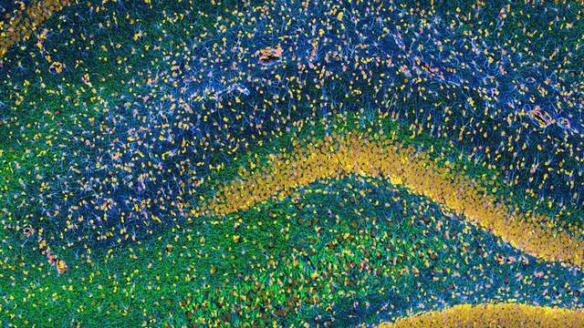 Microscope image of a rat brain slice in blue, green and gold. Curved gold bands of tightly packed cell nuclei trace the layers of the hippocampus.