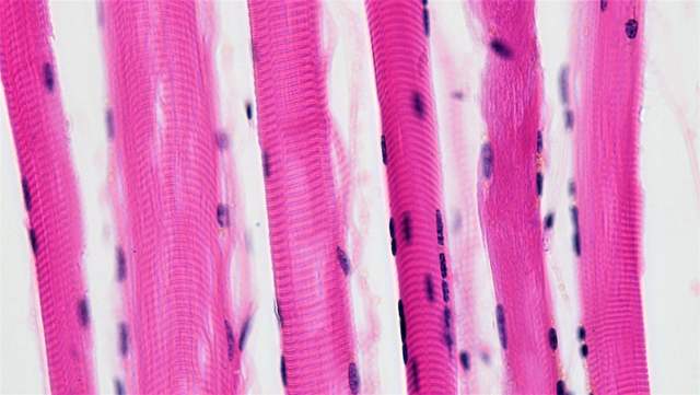Muscle fibres under a microscope: long pink strands with fine cross-stripes and dark nuclei along their edges.