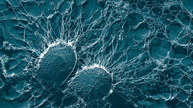 Two round bacteria under an electron microscope, surrounded by a web of fine threads, shown in blue-green.